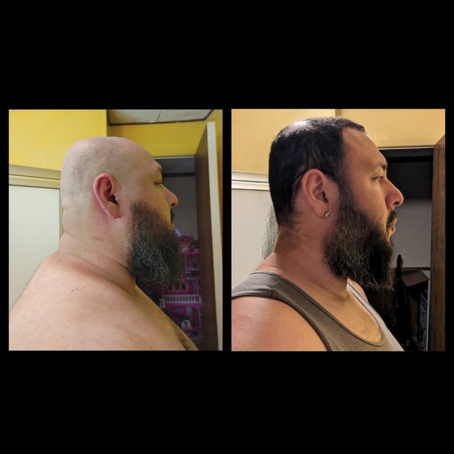 M/37/6' [351 > 281 = 70] I've started to yo-yo but this just motivated me all over again.