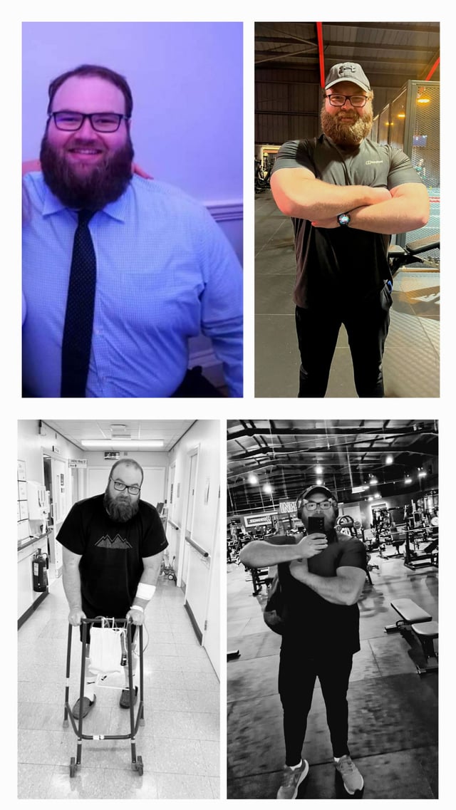 M/33/6'2"[349lbs > 274 = 75lbs] (18 months) update 4. Got cancer since my last update and had 4 major surgeries in 5 months, I've got some catching up to do but can't say how good it feels to be back in the gym.