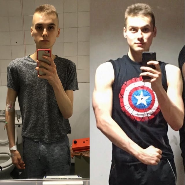 M/22/5'11" [99lbs > 150lbs = 51lbs] Anorexia my recovery