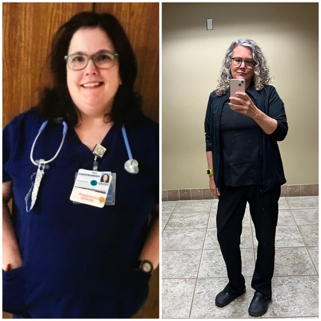 Photo of a 53-year-old woman lost 82 lbs (37kg) in 5 years. Photo 1