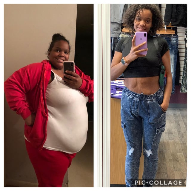 F/25/5’6” [317>140=177 lbs] May 19-Sep 20. I used to browse these posts anon for years and cry. Until I decided I was going to have my own picture up here. Shine baby! 😁