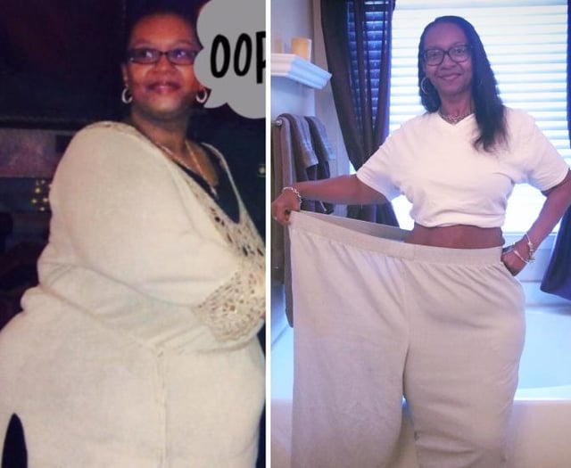Photo of a 49-year-old woman lost 159 lbs (72kg) in 9 years. Photo 1